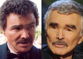6 Male Celebrities Who Admit Having Plastic Surgery Tappmd Celebrity Plastic Surgery Celebrities Male Plastic Surgery