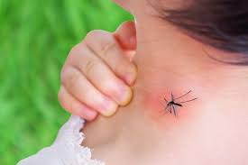 Image result for mosquito bite