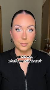 Understanding Blindness: Trending Topic Explained