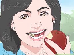 Don't use products with baking soda if you have braces, because it can damage them. 3 Ways To Remove Tea Stains From Teeth Wikihow