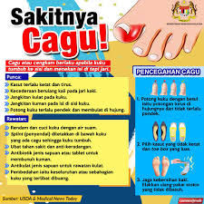 Menerima dan menyimpan ubat dan bukan ubat yang diterima daripada pembekal dan cawangan farmasi logistik negeri sabah (cflns) menggunakan sistem his (hospital inventory system). Potato Com Potatonesh Twitter