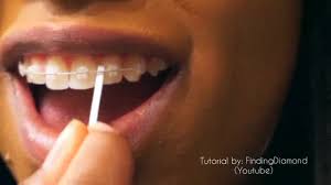 Help children floss with braces. Buy Braces Floss Platypus Flosser Orthopick Plackers Seetracker Malaysia