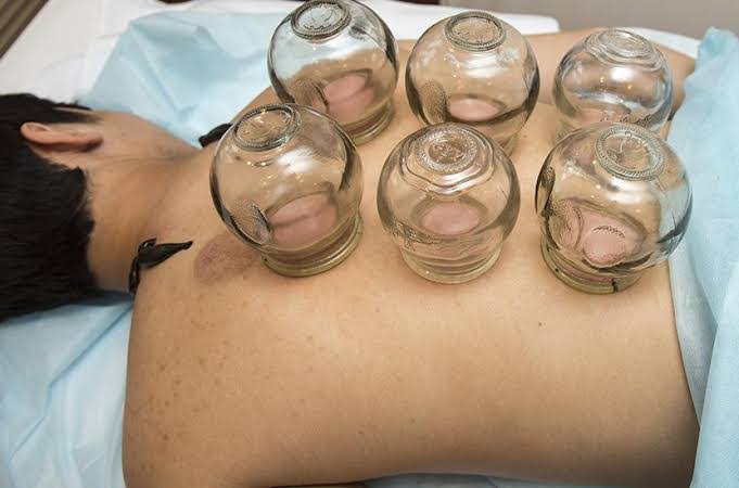 Neuro Acupuncture product image