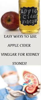 Easy Ways To Use Apple Cider Vinegar For Kidney Stones Apple Cider Vinegar Cures Kidney Stones Apple Cider Vinegar
