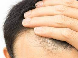 The hair follicle, the skin and the nails all benefit. Biotin For Hair Growth Dosage And Side Effects
