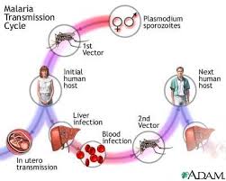 Bărbatul diagnosticat, în urmă cu o săptămână, cu cea mai gravă formă de malarie este încă internat la spitalul de boli infecţioase „sfânta parascheva din iaşi. Malaria Paludismul Bolile Infectioase