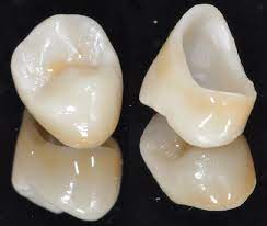 Zirconia Versus Pfm What Is Their Difference