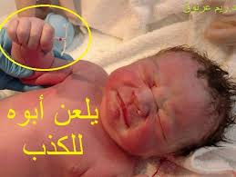 قد تُصاب المرأة بمرض تكيس المبايض. ØµØ¯ÙŠÙ‚ØªÙŠ 90 Ù…Ù† Ø§Ù„Ù‚ØµØµ Ø§Ù„Ù…ÙˆØ¬ÙˆØ¯Ø© Ø¹Ù„Ù‰ Ø¯ÙƒØªÙˆØ±ØªÙŠ Ø±ÙŠÙ… Ø¹Ø±Ù†ÙˆÙ‚ Facebook