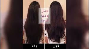 علاج تساقط الشعر مضمون 100 6 طرق فعالة لعلاج تساقط الشعر