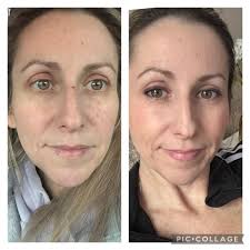 Why do legs feel heavy with low sugar?