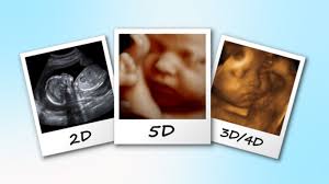 Siêu âm nhiều có gây dị tật thai nhi, khiến trẻ lớn lên luôn nhăn nhó, cáu  gắt?