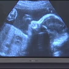 Planned parenthood president cecile richards testified before the house oversight and government reform committee. Ohio Bill Would Prevent Insurance For Paying For Abortions Limit Birth Control Coverage Wkrc