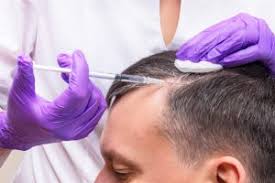 مراكز علاج الشعر بجدة أفضل خبراء العلاج موثوق Mawthook