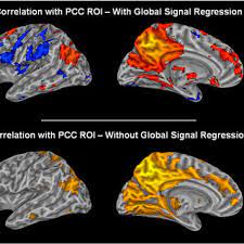 Daca vrei sa transformi un submultiplu in metru trebuie sa imparti. Pdf The Impact Of Global Signal Regression On Resting State Correlations Are Anti Correlated Networks Introduced