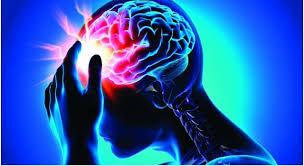 Dementia is a broad term for a group of symptoms that mean you have trouble with learning and memory. The Cognitive Disorder Prosopagnosia Trivia Questions Quizzclub