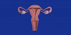 Ciuperca intre degete se manifesta prin roseata in zona respectiva si mancarimi, in special intre degetele si 5. Cancerul Vulvar Semne Cauze Si Tratament Cancer360