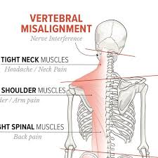 Postural Imbalance Etsy In 2020 Imbalance Chiropractic Care Subluxation