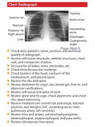 Image result for Chest XRay Interpretation