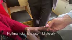 Image result for Hoffman Sign