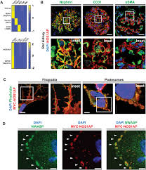 Google's made massive shifts in the way that it's displayed search results over the there's a lot of different ways that google is now displaying information, and they use structured data to help them understand the content on a page. Recessive Nos1ap Variants Impair Actin Remodeling And Cause Glomerulopathy In Humans And Mice Science Advances