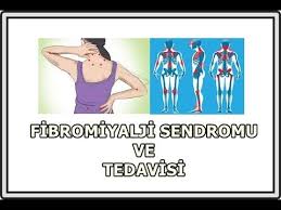 Fibromiyalji, yaygın kas iskelet sistemi ağrısı, uyku bozukluğu ve yorgunluğun birlikte görüldüğü bir ağrı sendromudur. Fibromiyalji Sendromu Ve Tedavisi Youtube
