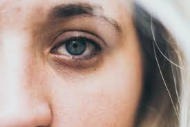 Namun, cara menghilangkan kantong mata ini hanya bisa dilakukan oleh dokter kulit atau dokter ahli estetika. Jom Hilangkan Lingkaran Bawah Mata Panda Dengan 10 Produk Ini 100comments Product Reviews Samples News
