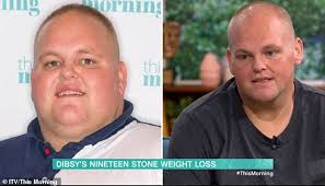 Obese Dibsy, 28, reveals results of 19st weight loss but needs to raise  £15k to pay for skin removal