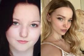 Dove Cameron Plastic Surgery Journey