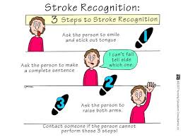 Stroke Nursing Mnemonics See More Http Www Nursebuff Com Nursing Mnemonics Nursing Mnemonics Medical Surgical Nursing Nurse