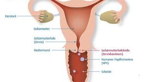 Hpv is not a new virus. Gebarmutterhalskrebs Risiken Vorsorge Hpv Impfung Krebs Ratgeber Rat Hilfe