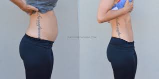 Lose The Pooch 5 Exercises To Get Rid Of The Mommy Tummy Diary Of A Fit Mommy Mommy Tummy Mommy Workout Lose Baby Belly