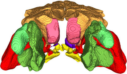 Cross-Sectional Sinus Mapping Layer, AI generated