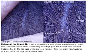 Image result for lice vs dandruff