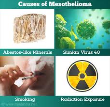 For smoking and mesothelioma, it's also important to note that asbestos which makes its way into despite much suspicion of a link between smoking and mesothelioma, it has not been recognized. Mesothelioma Causes Symptoms Diagnosis Treatment Prevention