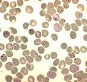 Penyakit ini paling sering ditemukan di daerah tropis. Ausgabe 3 2017 Malaria Aktuelle Situation Und Neue Trends