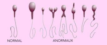 Tératospermie solution naturelle