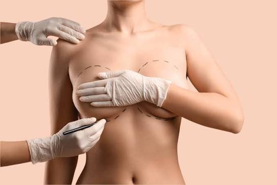Breast Augmentation and Enlargement Surgery in Dubai | BROWZ