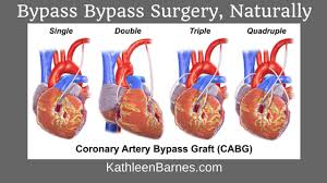 We did not find results for: Angioplasty