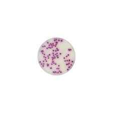 In products intended for human or animal consumption, or in environmental samples. Salmonella Chromogenic Agar Formato 500 G