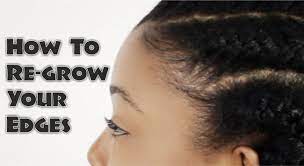 Three Tips To Revive Those Thinning Edges Natural Hair Styles Grow Thick Long Hair Hair Styles