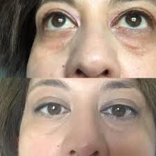 Beautiful Skin by Britt