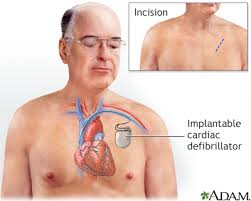 To help treat these symptoms, your healthcare provider is recommending a biventricular pacemaker and implantable cardioverter defibrillator (icd). Implantable Cardioverter Defibrillator Discharge Information Mount Sinai New York