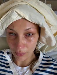Kiriman terakhir Bella Hadid. : r/LAinfluencersnark
