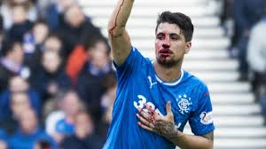 Game log, goals, assists, played minutes, completed passes and shots. 561941 Fabio Cardoso Broken Nose Oct 2017 Ninety Minutes Online