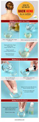 Home Remedies To Get Rid Of Back Acne In A Week Home Remedies For Acne Skin Care Acne Back Acne Treatment