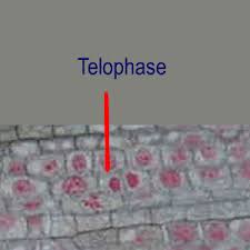 Maybe you would like to learn more about one of these? Microscopy