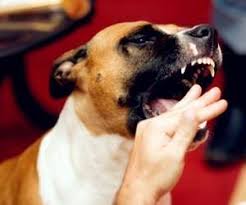 訓練狗不咬人及咬傷處理方法 生活專家 dog biting dog training dog behavior