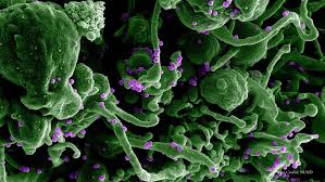 Image result for Lassa Fever