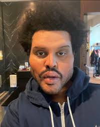 ✓ free for commercial use ✓ high quality images. The Weeknd S Dramatic Plastic Surgery Enhanced Face For Save Your Tears Music Video Leaves Fans Stunned Thejasminebrand