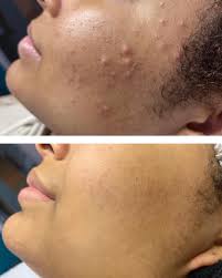 Indy Skin Whisperer‎